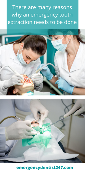 Why-Do-You-Need-an-Emergency-Tooth-Extraction-ed247